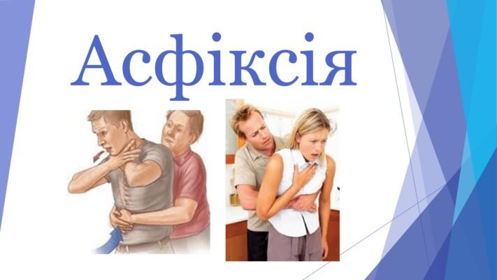 Асфіксія це: причини, симптоми та як надати першу допомогу