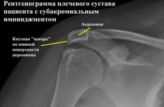 Імпіджмент синдром: що це таке, симптоми та лікування проблеми