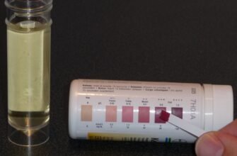 Ацетонурія: причини, симптоми та методи діагностики і лікування