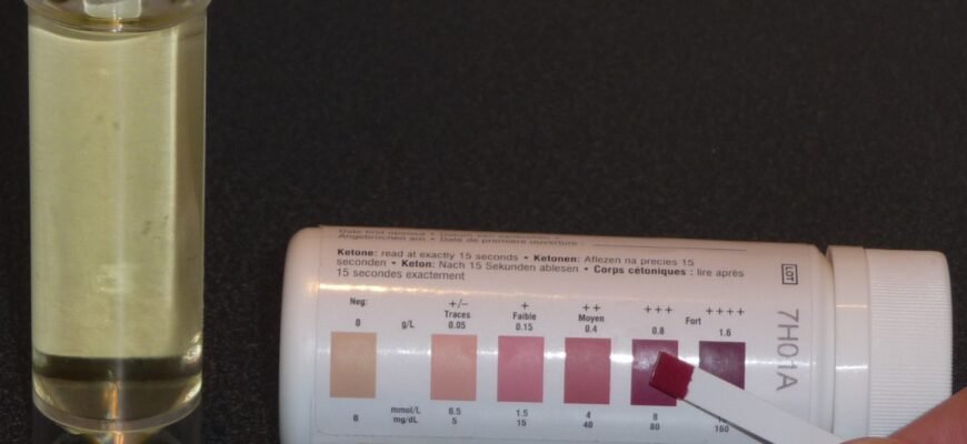 Ацетонурія: причини, симптоми та методи діагностики і лікування