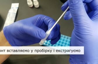 Як самостійно провести тест на стрептокок: покрокова інструкція