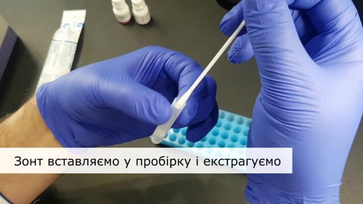 Як самостійно провести тест на стрептокок: покрокова інструкція