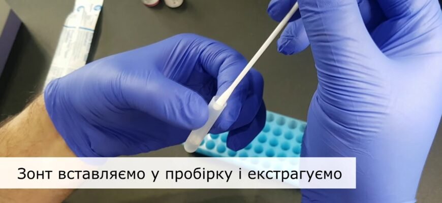 Як самостійно провести тест на стрептокок: покрокова інструкція