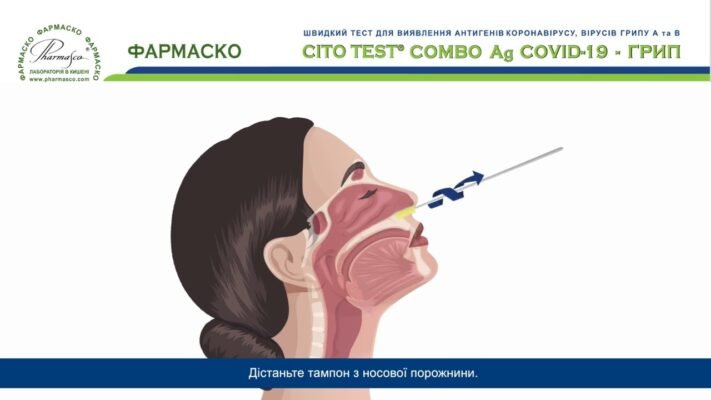 Як самостійно провести тест на грип вдома: покрокова інструкція Як самостійно провести тест на грип вдома: покрокова інструкція