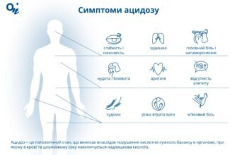 Ацидоз: що це таке, причини, симптоми та методи лікування