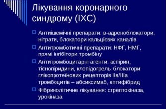 Ознаки та лікування коронарного синдрому: важливі аспекти здоров’я
