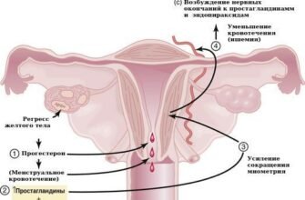 Альгодисменорея: причини, симптоми та способи полегшення болю