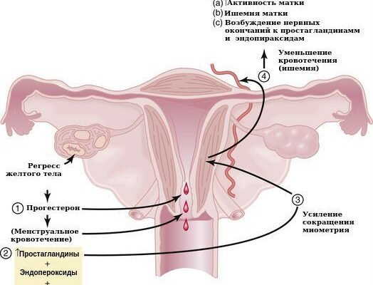 Альгодисменорея: причини, симптоми та способи полегшення болю