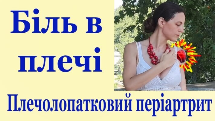 Періартрит: основні симптоми, причини, діагностика та лікування Періартрит: основні симптоми, причини, діагностика та лікування