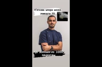 Плантарний фасциїт: що це таке, симптоми та ефективне лікування