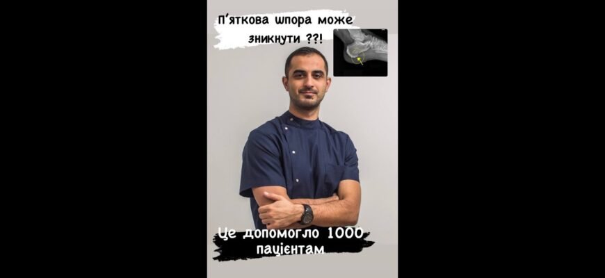 Плантарний фасциїт: що це таке, симптоми та ефективне лікування