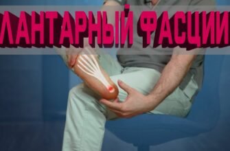 Що таке фасциїт? Причини, симптоми та методи лікування захворювання