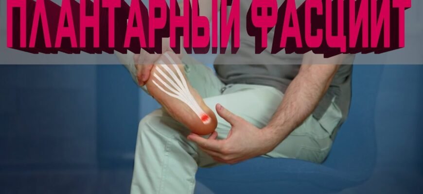 Що таке фасциїт? Причини, симптоми та методи лікування захворювання