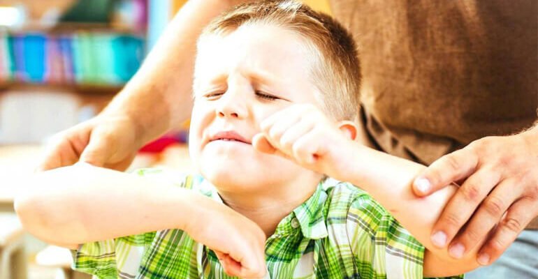 Синдром Джейкобса: Причини, симптоми та діагностика захворювання