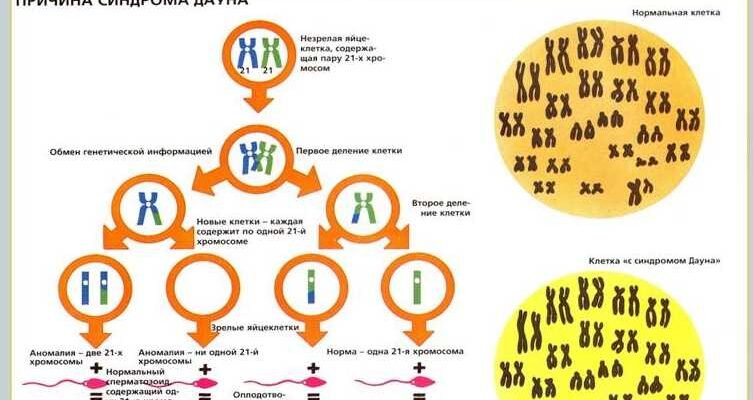 Синдром надшлуночкового гребінця: симптоми, діагностика та лікування