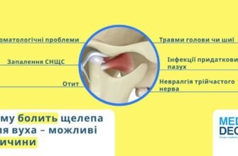 Синдром палаючого рота: симптоми, причини та методи лікування