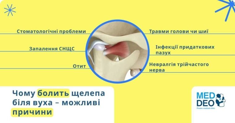 Синдром палаючого рота: симптоми, причини та методи лікування