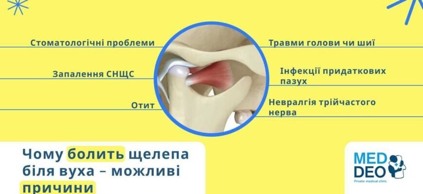 Синдром палаючого рота: симптоми, причини та методи лікування