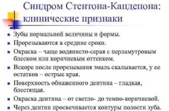 Синдром Стентона-Капдепона: Причини, Симптоми та Діагностика