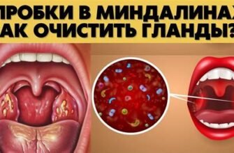 Як досягти червоного кольору горла: поради та рекомендації