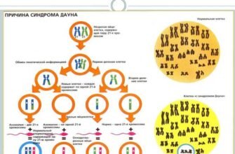Відкрийте світ Pandas-синдрому: симптоми, діагностика та лікування