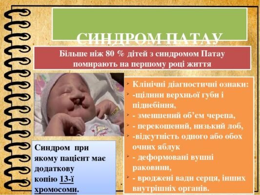 Виживання дорослих із синдромом Патау: виклики та реалії життя