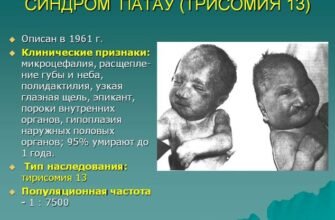 Злоякісний нейролептичний синдром: симптоми, діагностика та лікування