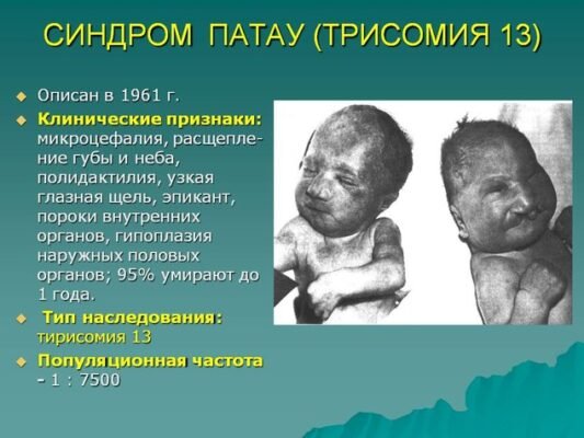 Злоякісний нейролептичний синдром: симптоми, діагностика та лікування Злоякісний нейролептичний синдром: симптоми, діагностика та лікування