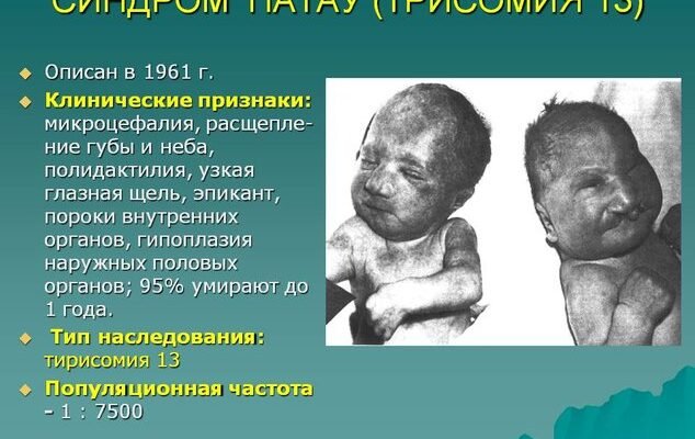 Злоякісний нейролептичний синдром: симптоми, діагностика та лікування